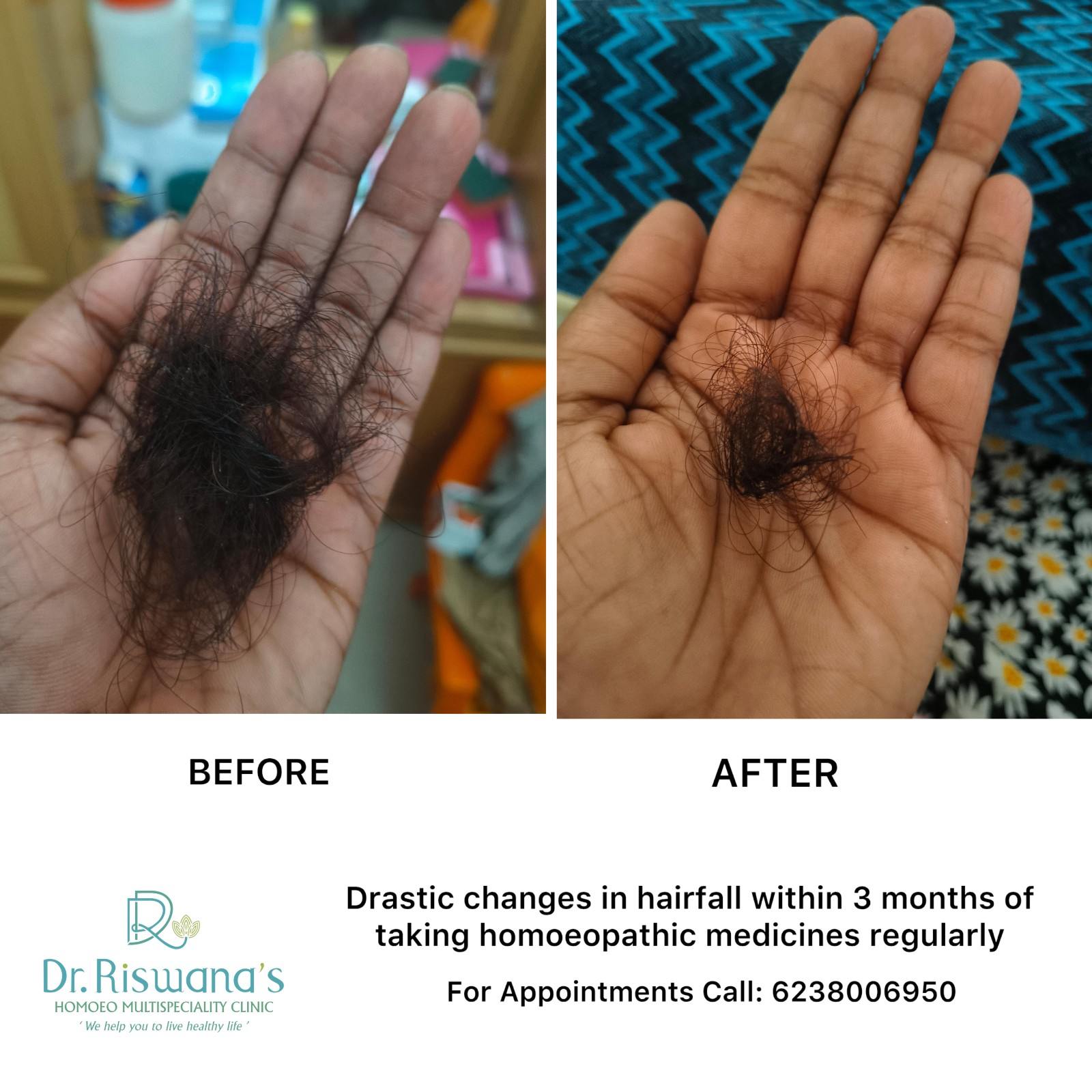 Hair Treatment